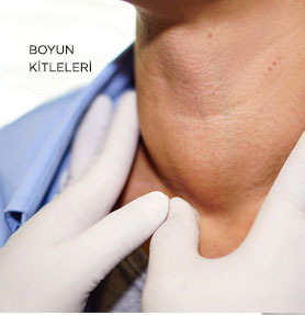 Boyun Kitleleri