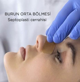 Septoplasti (Burun Orta Bölmesi Cerrahisi)
